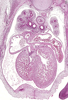 A histology section of a human embryo