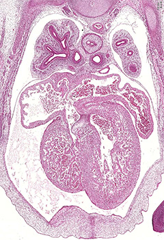 A histology section of a human embryo