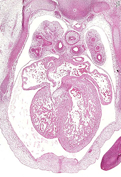 A histology section of a human embryo