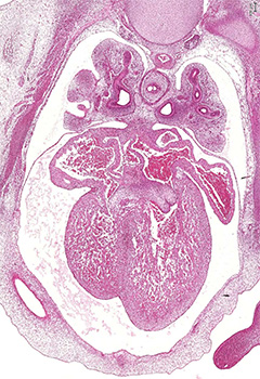 A histology section of a human embryo