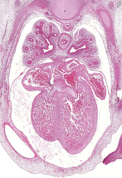 A histology section of a human embryo