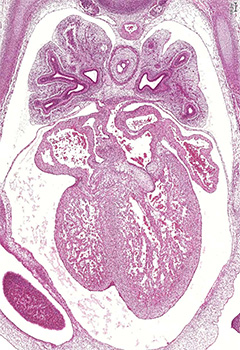 A histology section of a human embryo