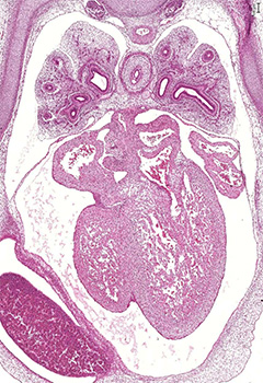 A histology section of a human embryo