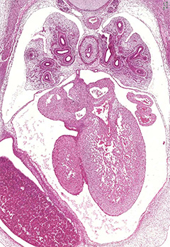 A histology section of a human embryo