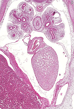 A histology section of a human embryo