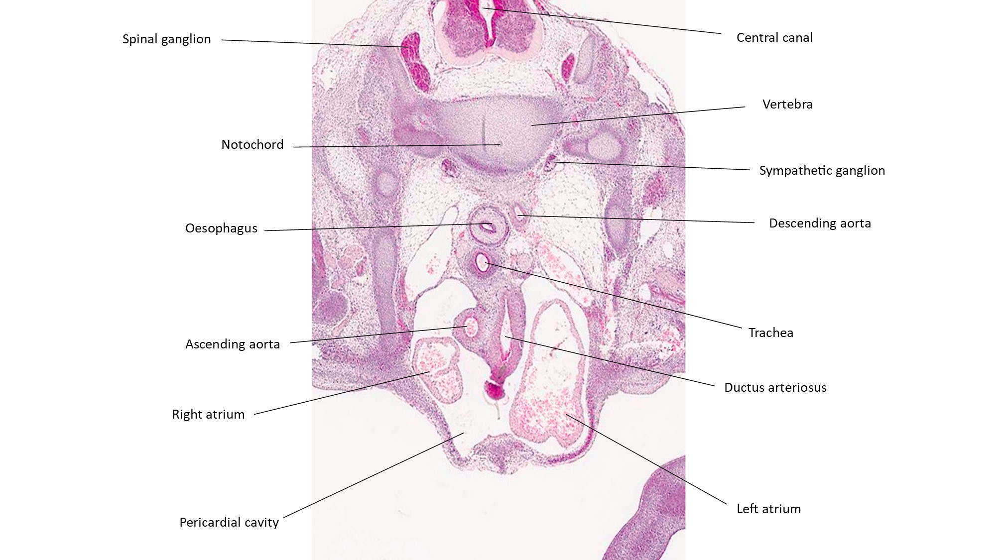 A histology section of a human embryo