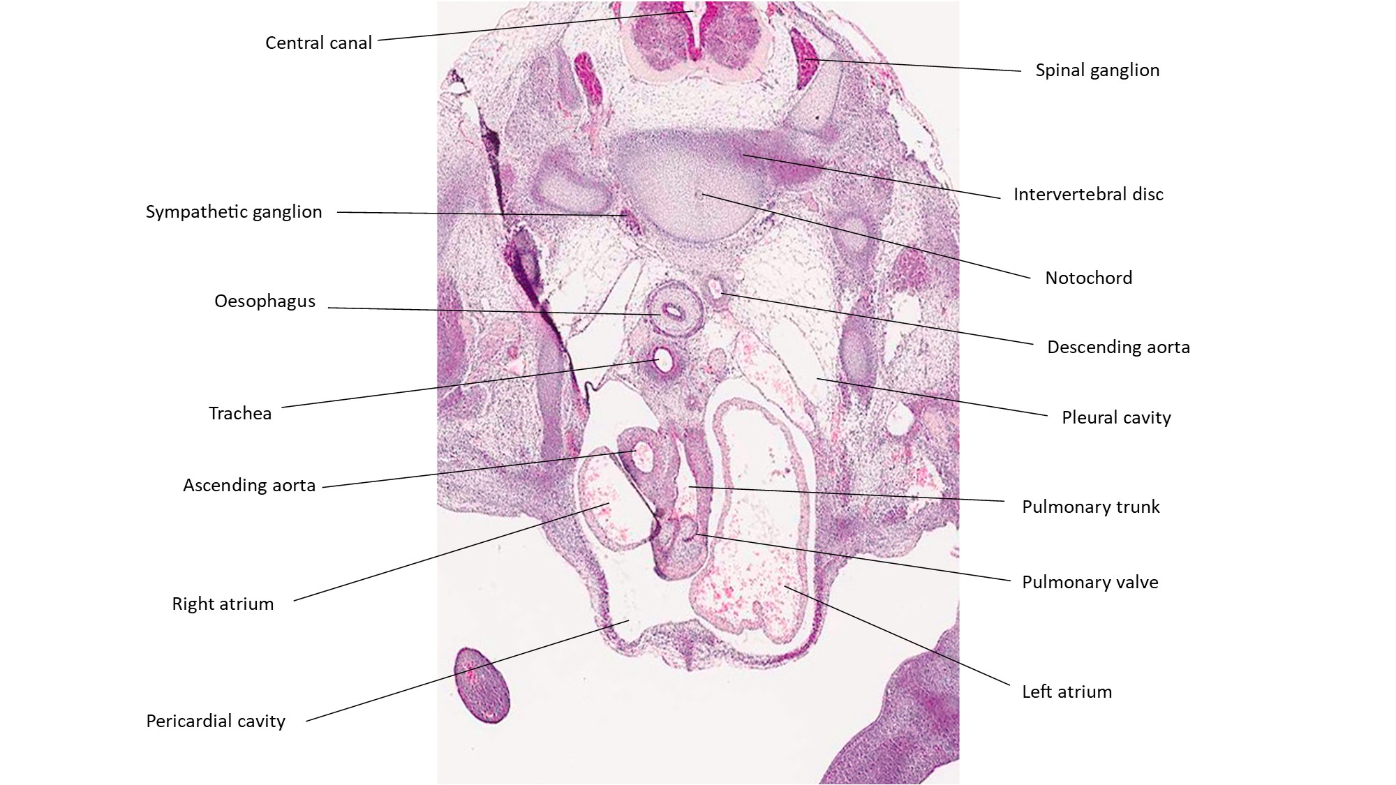 A histology section of a human embryo