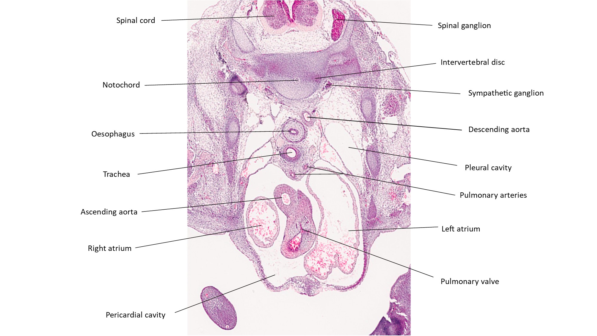 A histology section of a human embryo