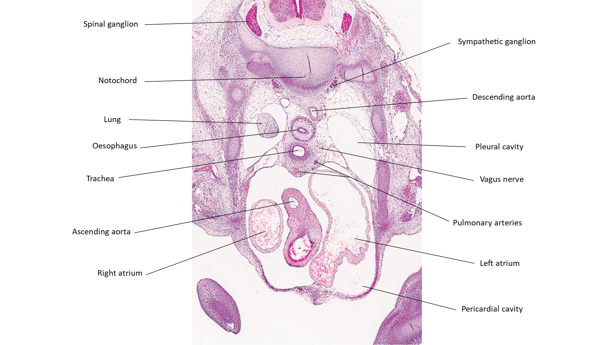 A histology section of a human embryo