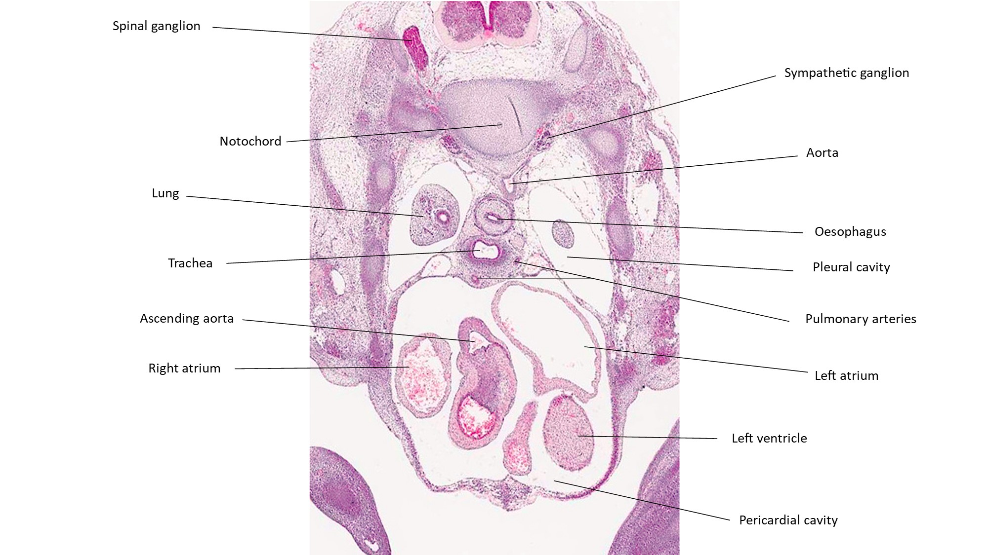 A histology section of a human embryo