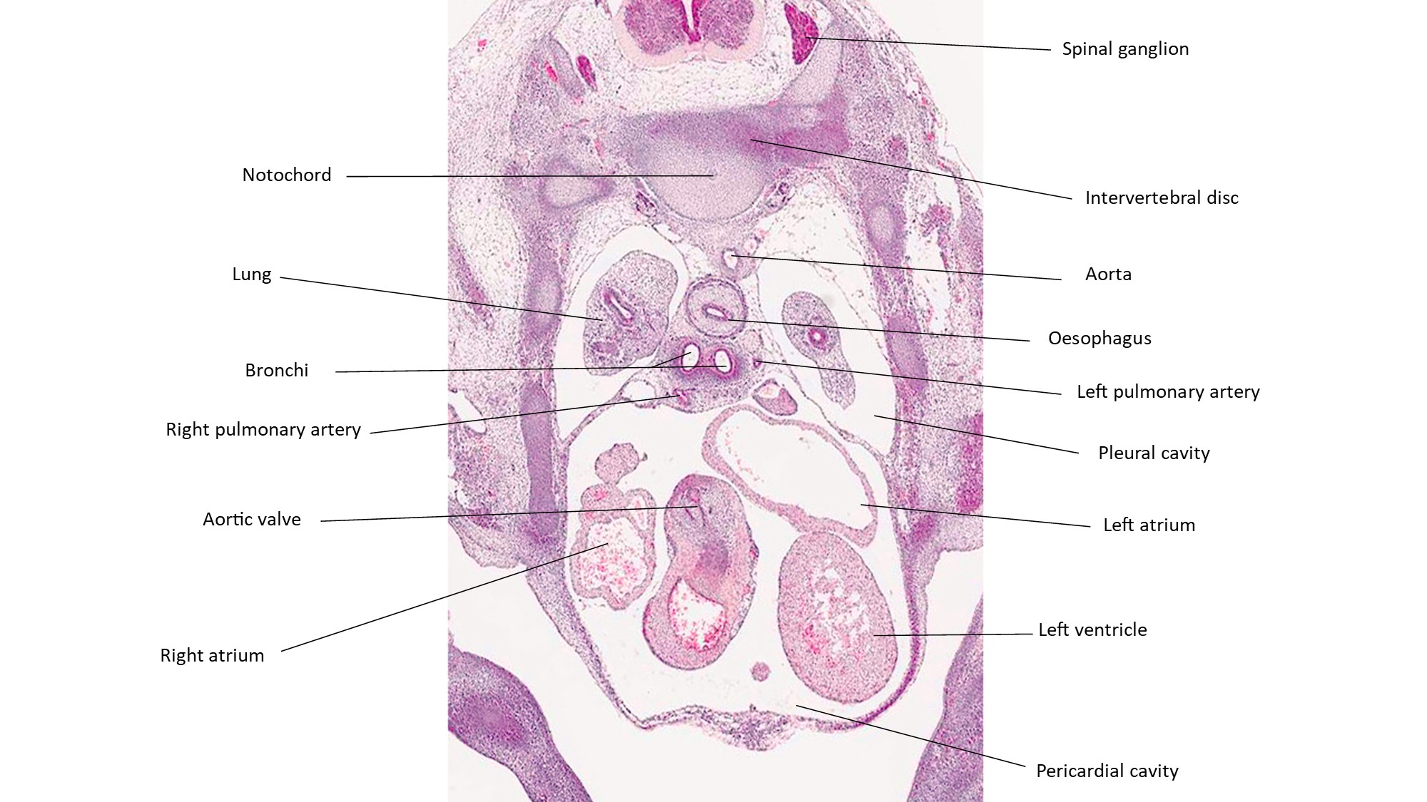 A histology section of a human embryo
