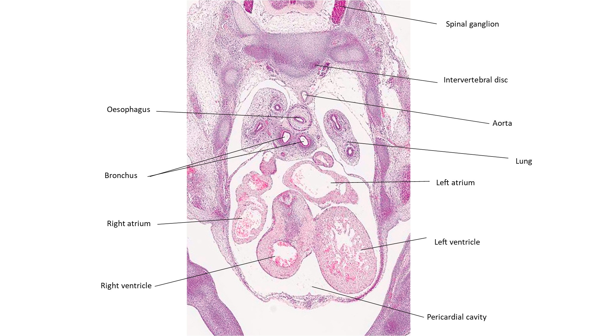 A histology section of a human embryo