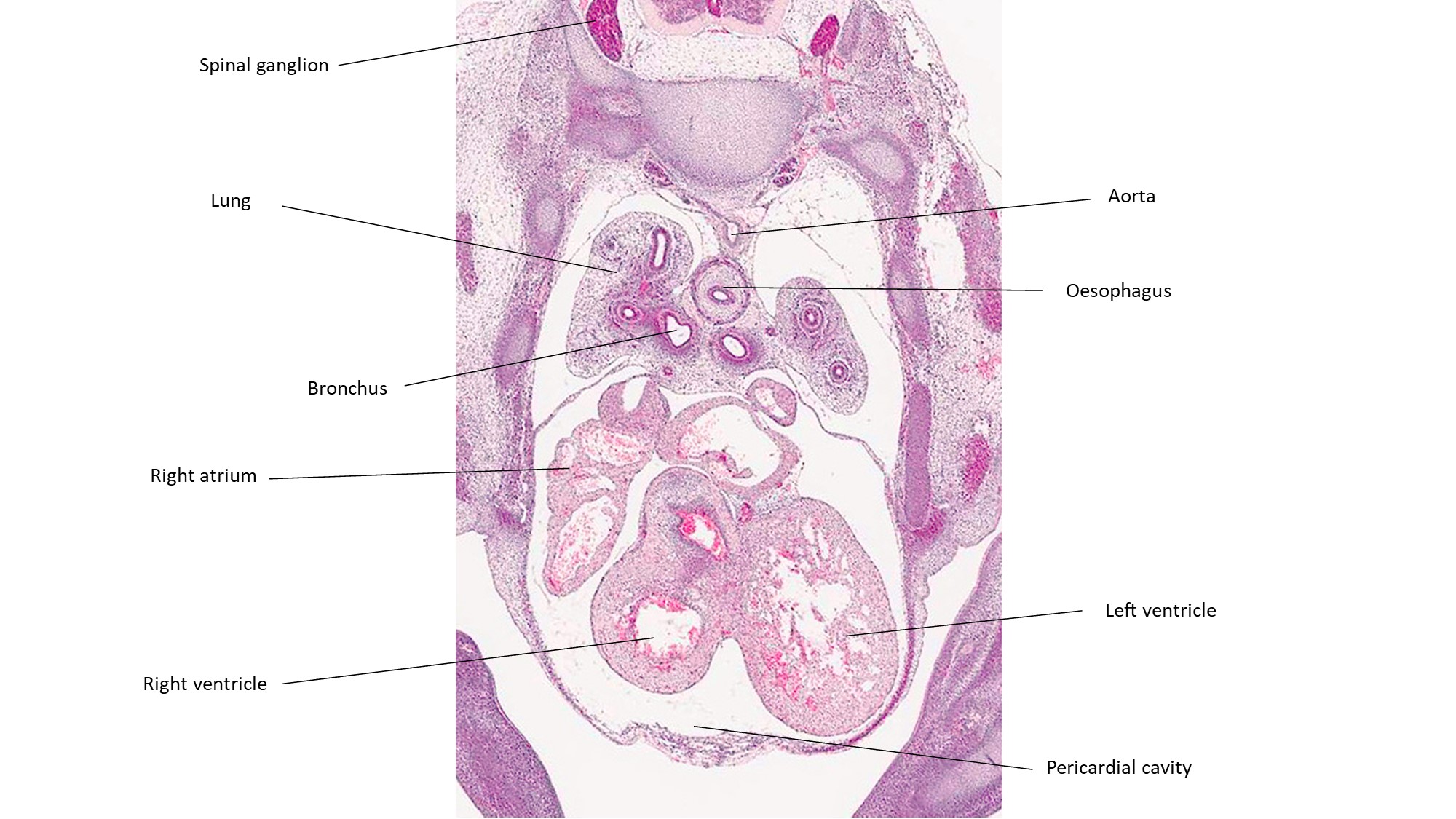 A histology section of a human embryo