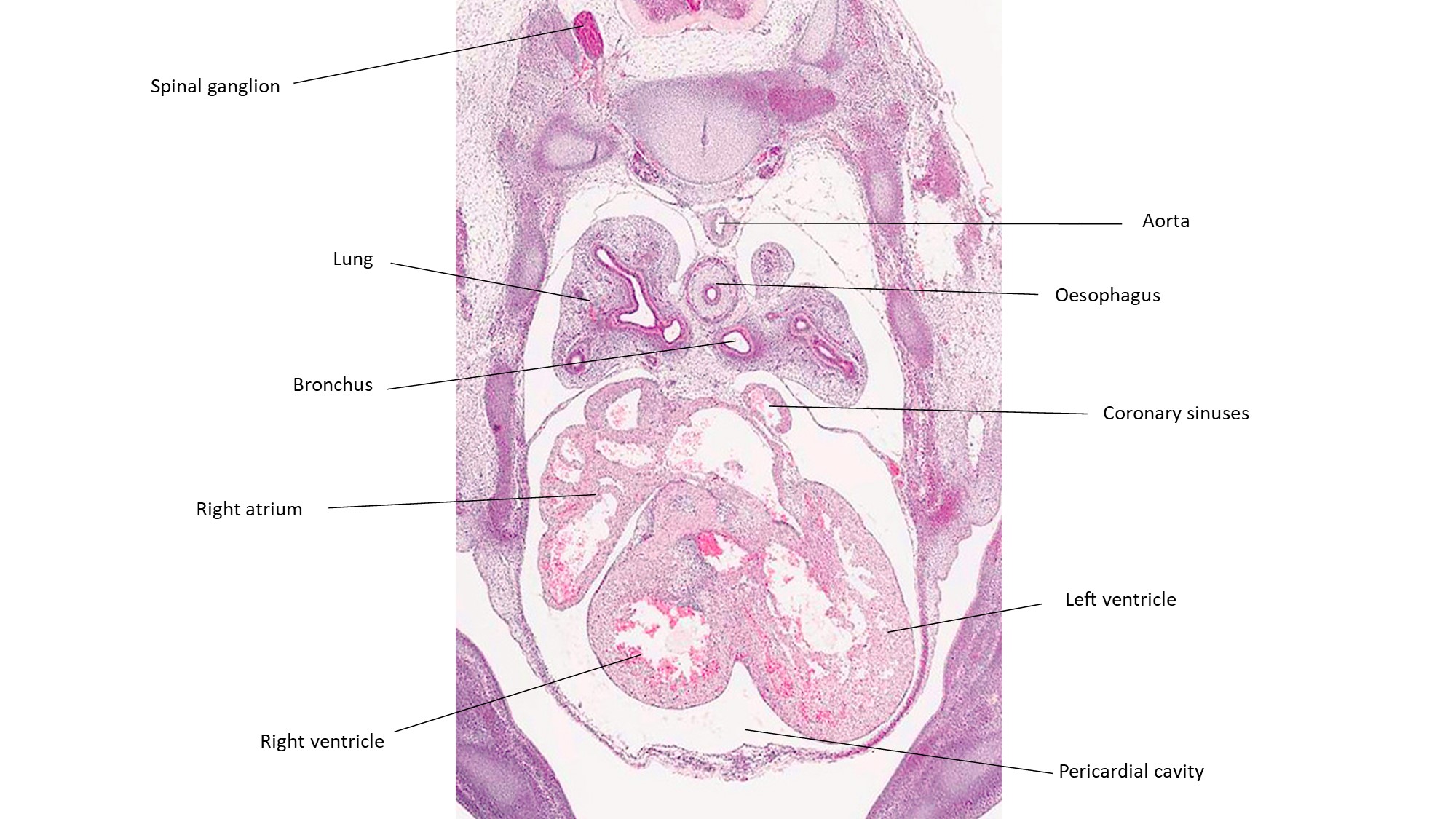A histology section of a human embryo