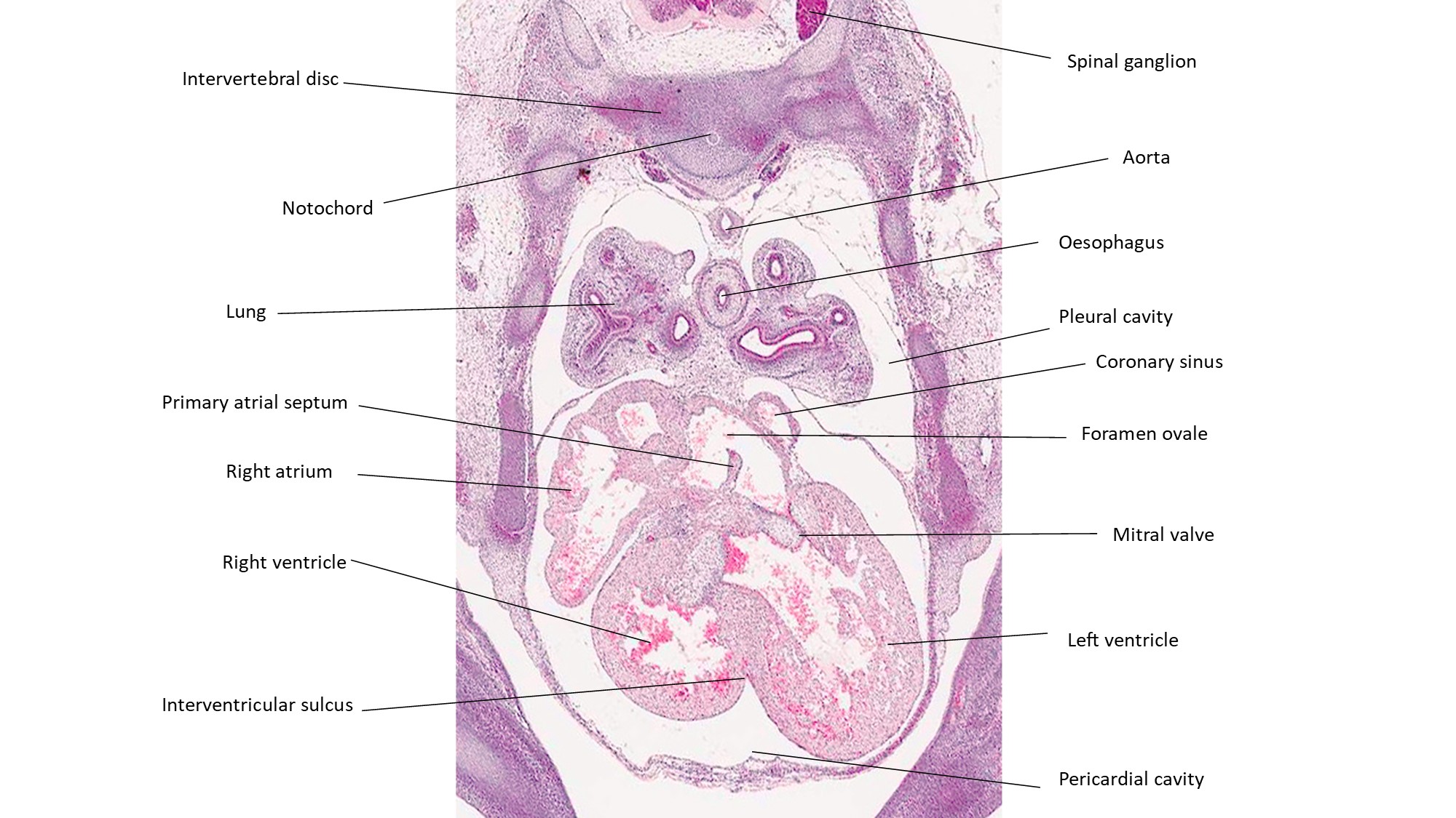 A histology section of a human embryo