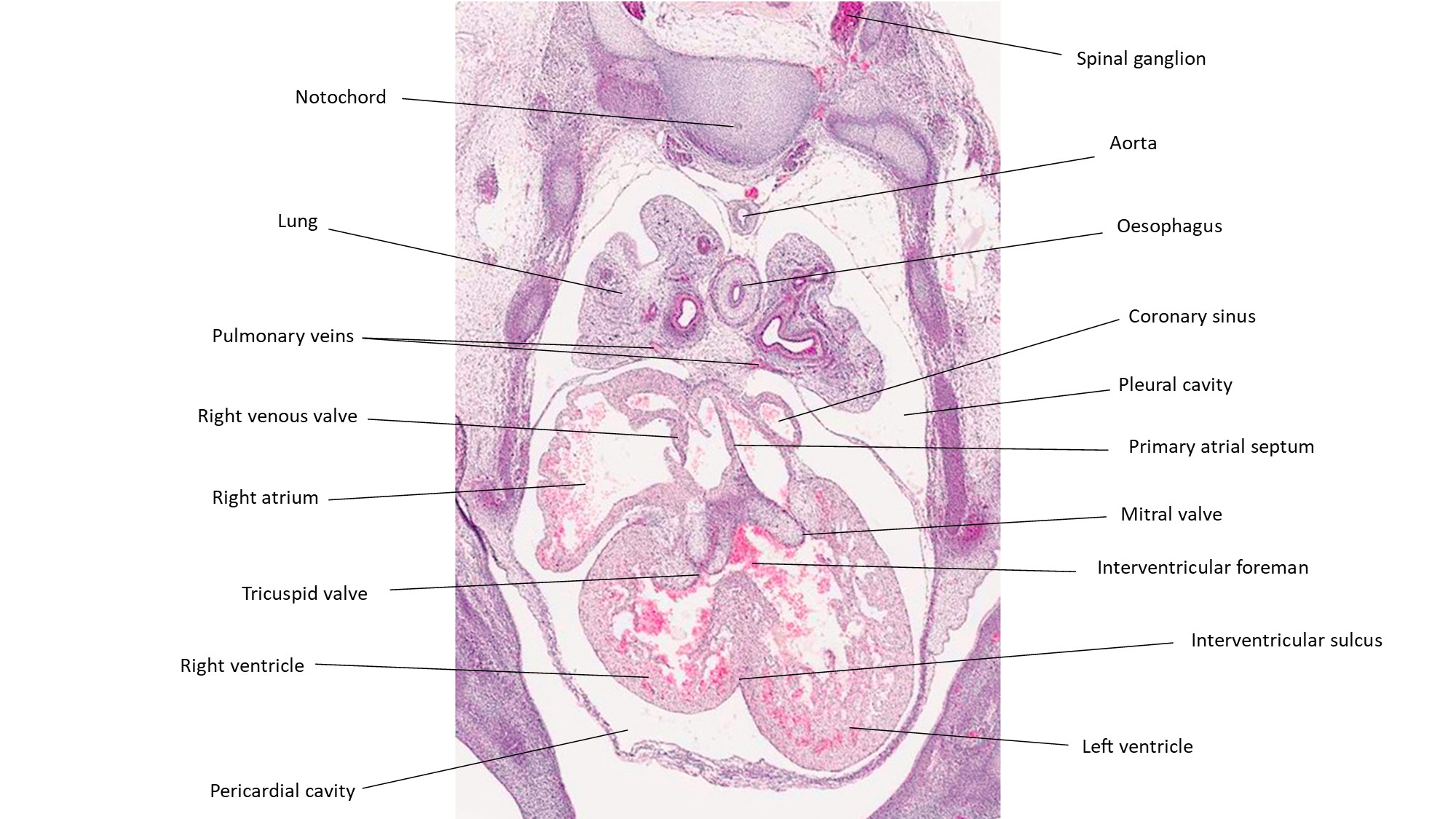 A histology section of a human embryo
