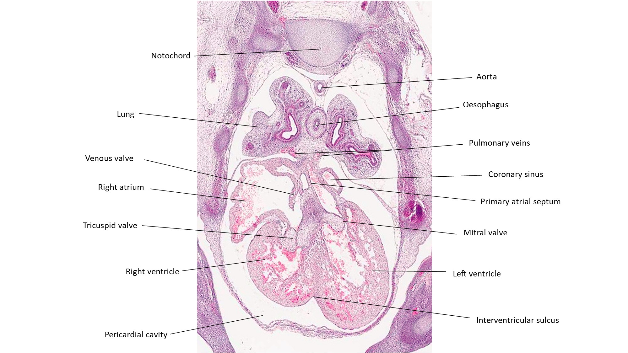 A histology section of a human embryo