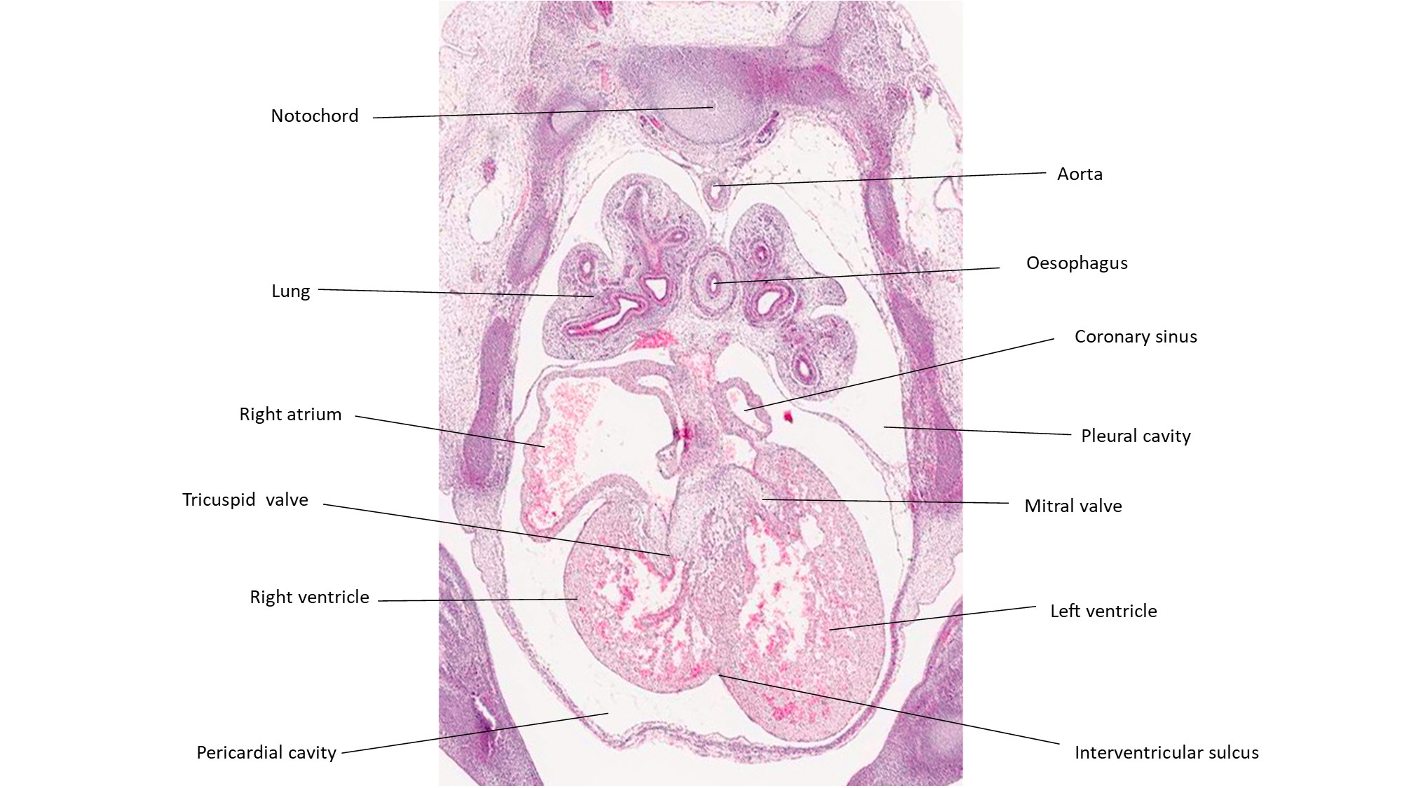 A histology section of a human embryo