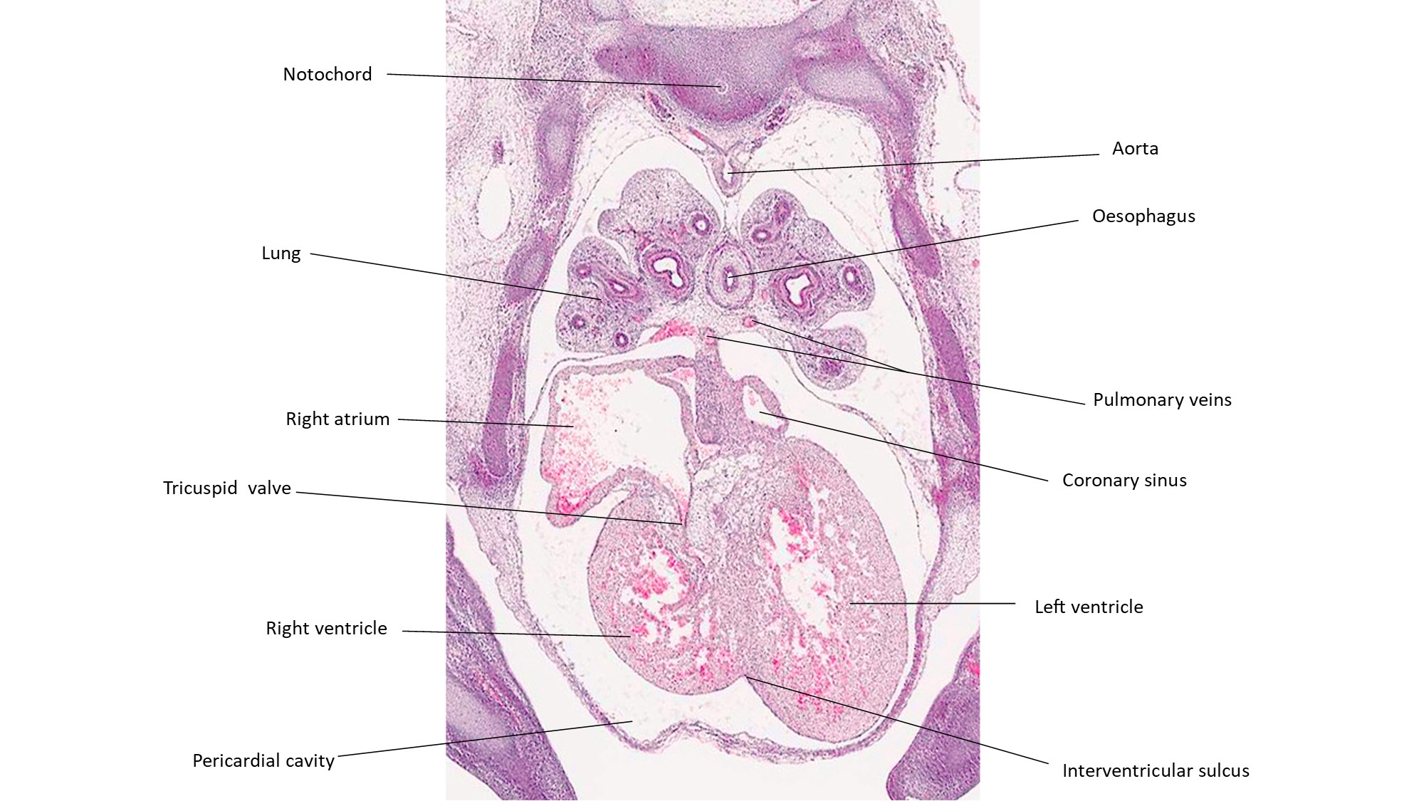 A histology section of a human embryo
