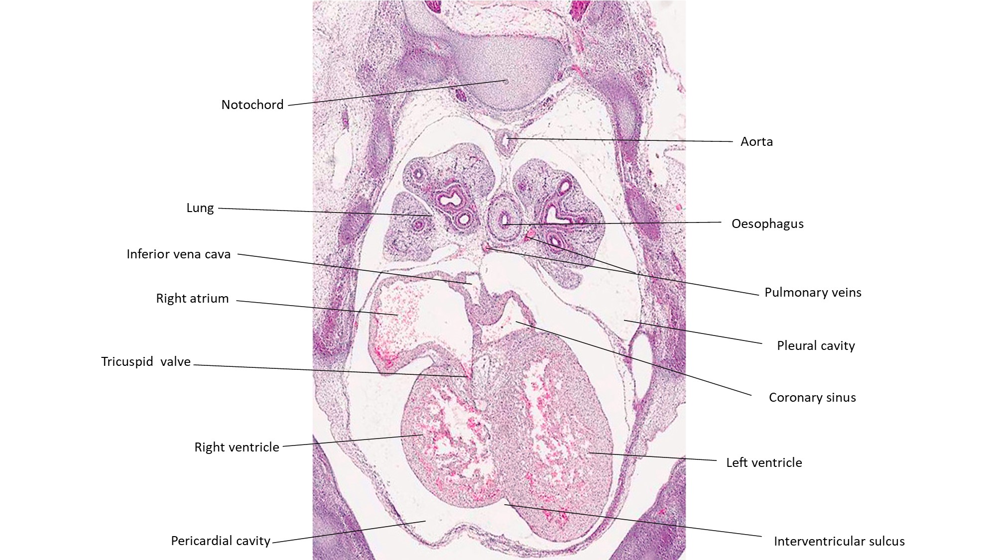 A histology section of a human embryo