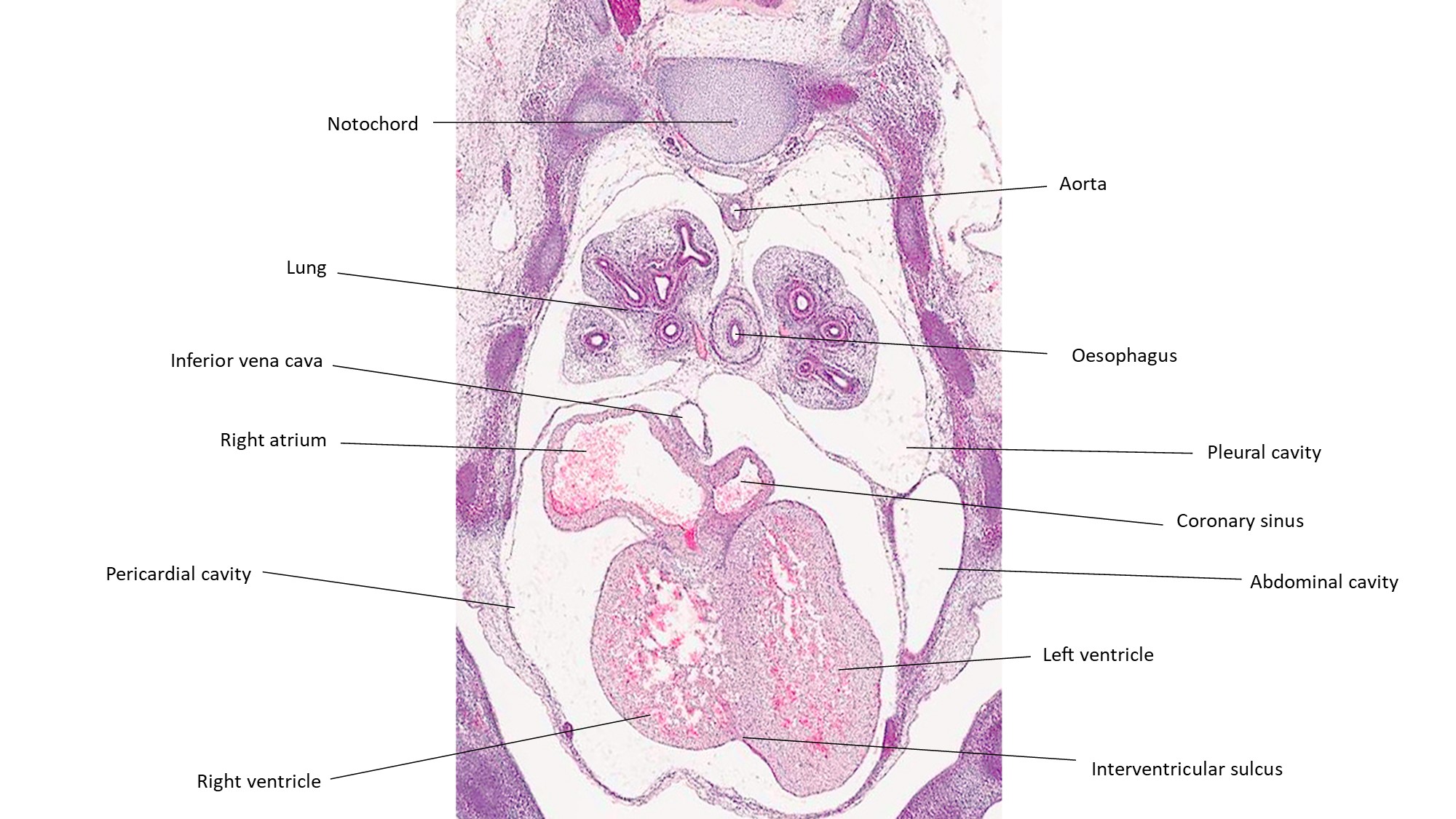 A histology section of a human embryo