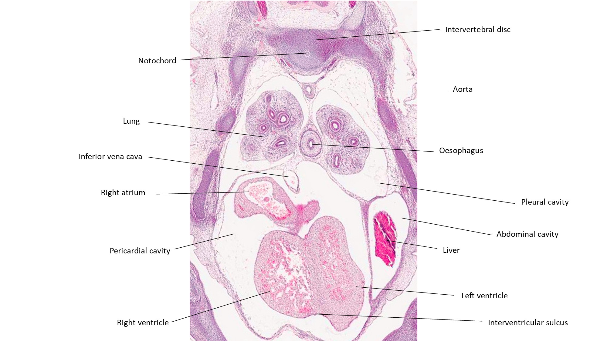 A histology section of a human embryo