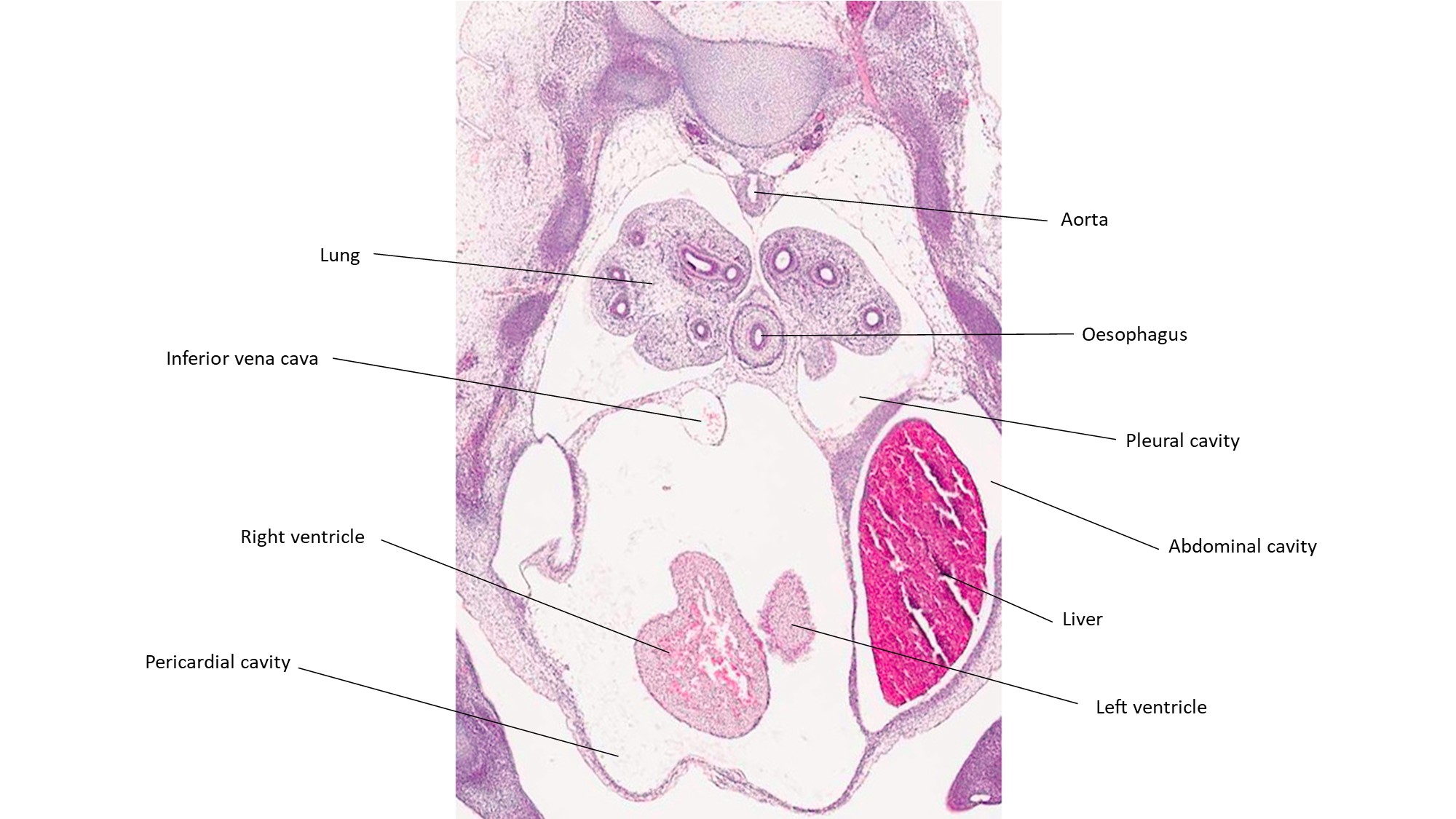 A histology section of a human embryo