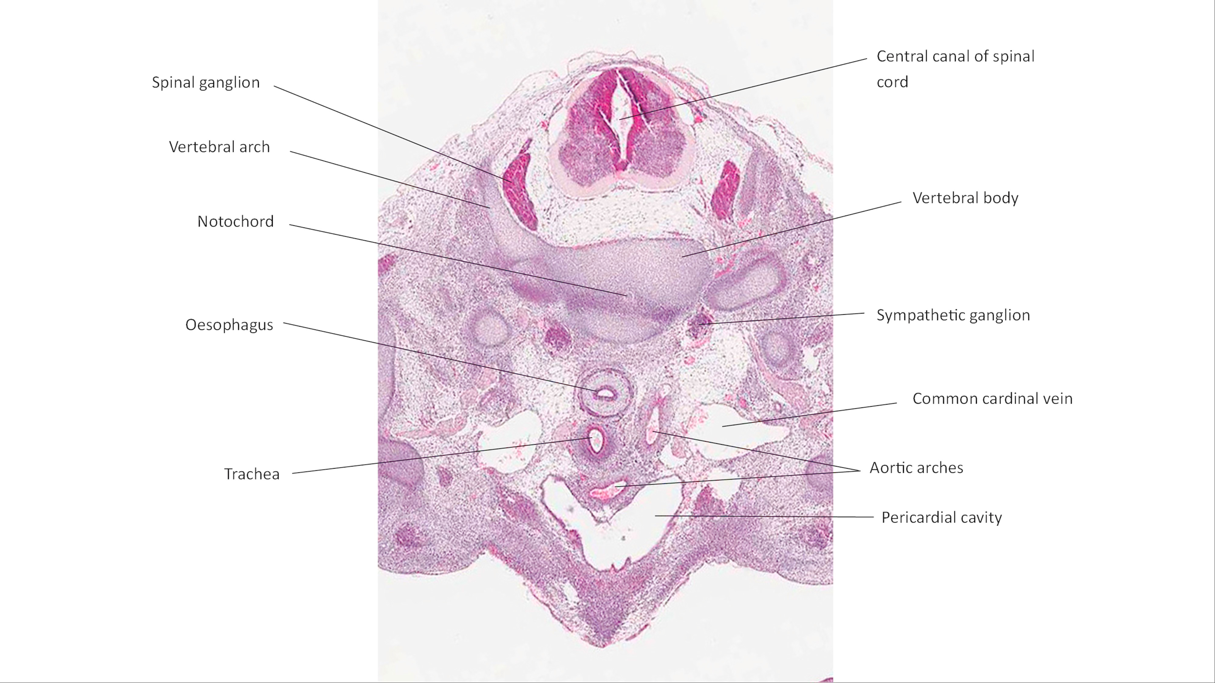 A histology section of a human embryo