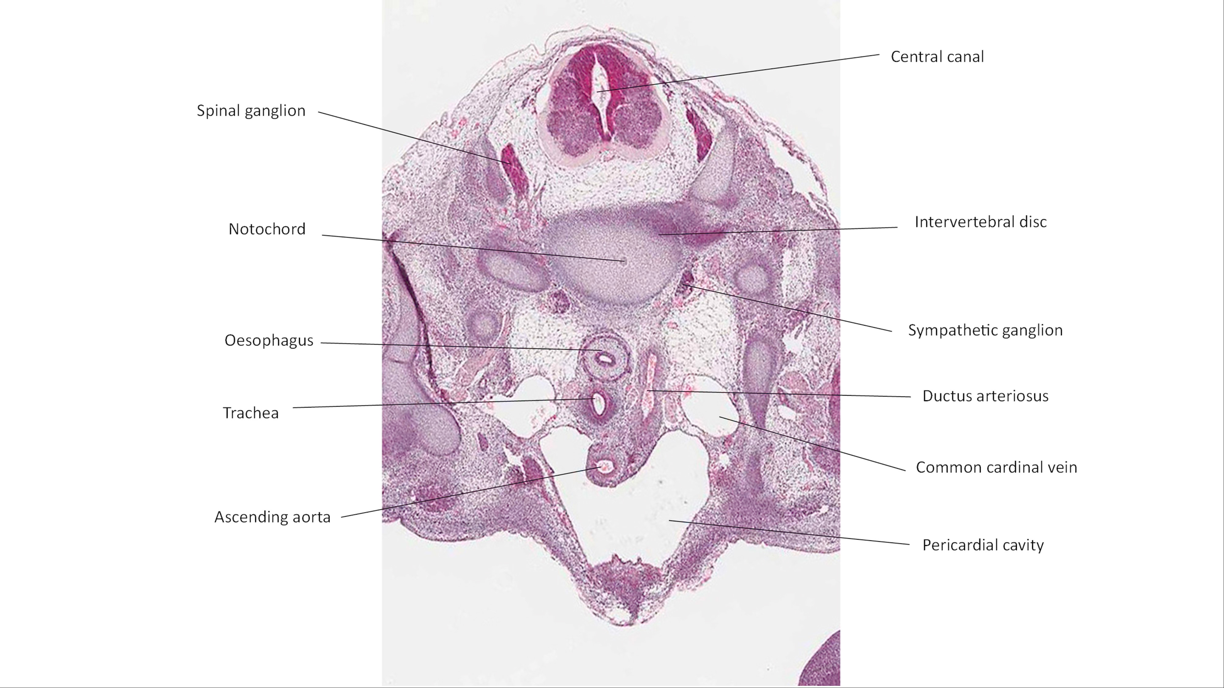 A histology section of a human embryo