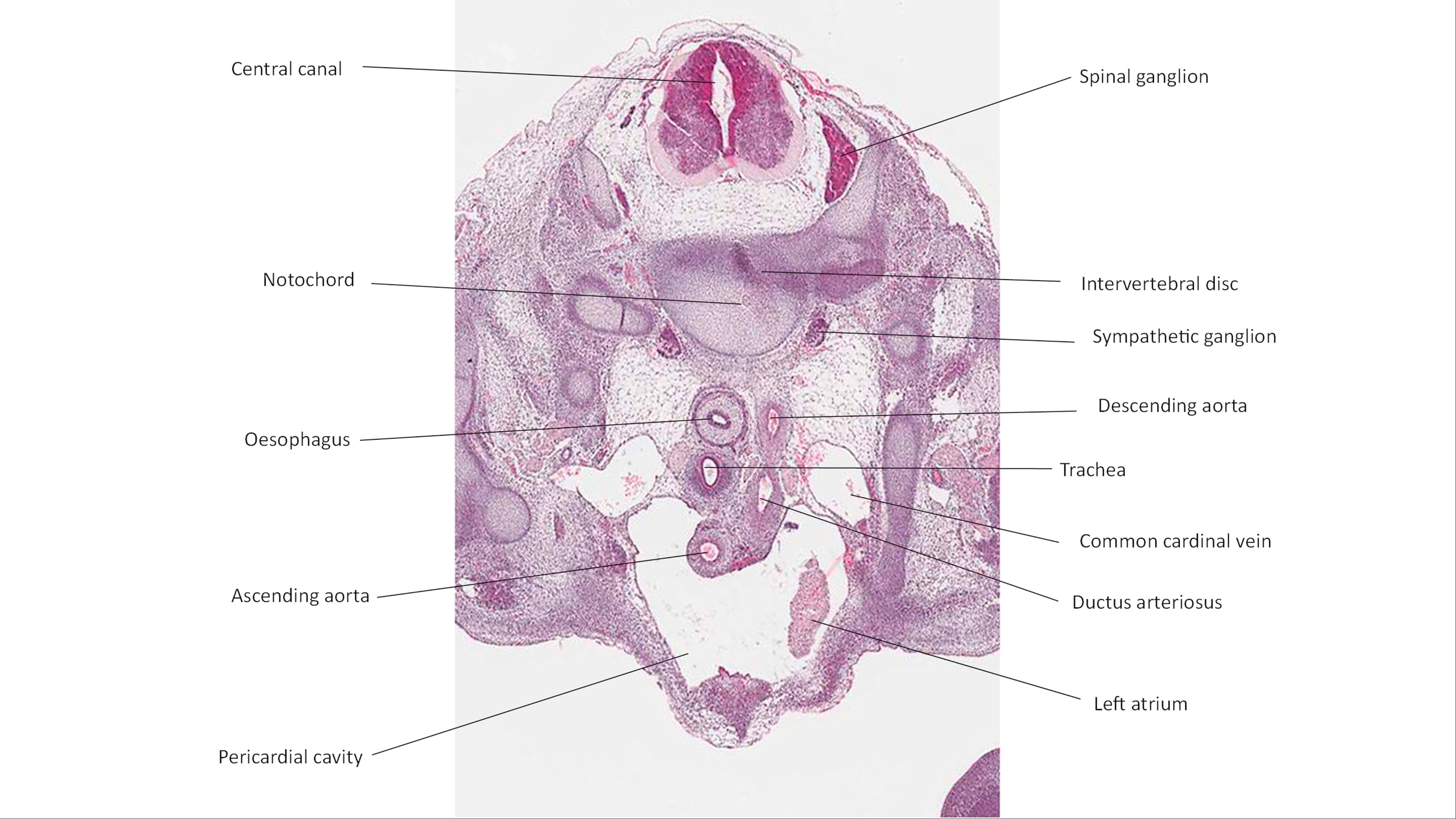 A histology section of a human embryo
