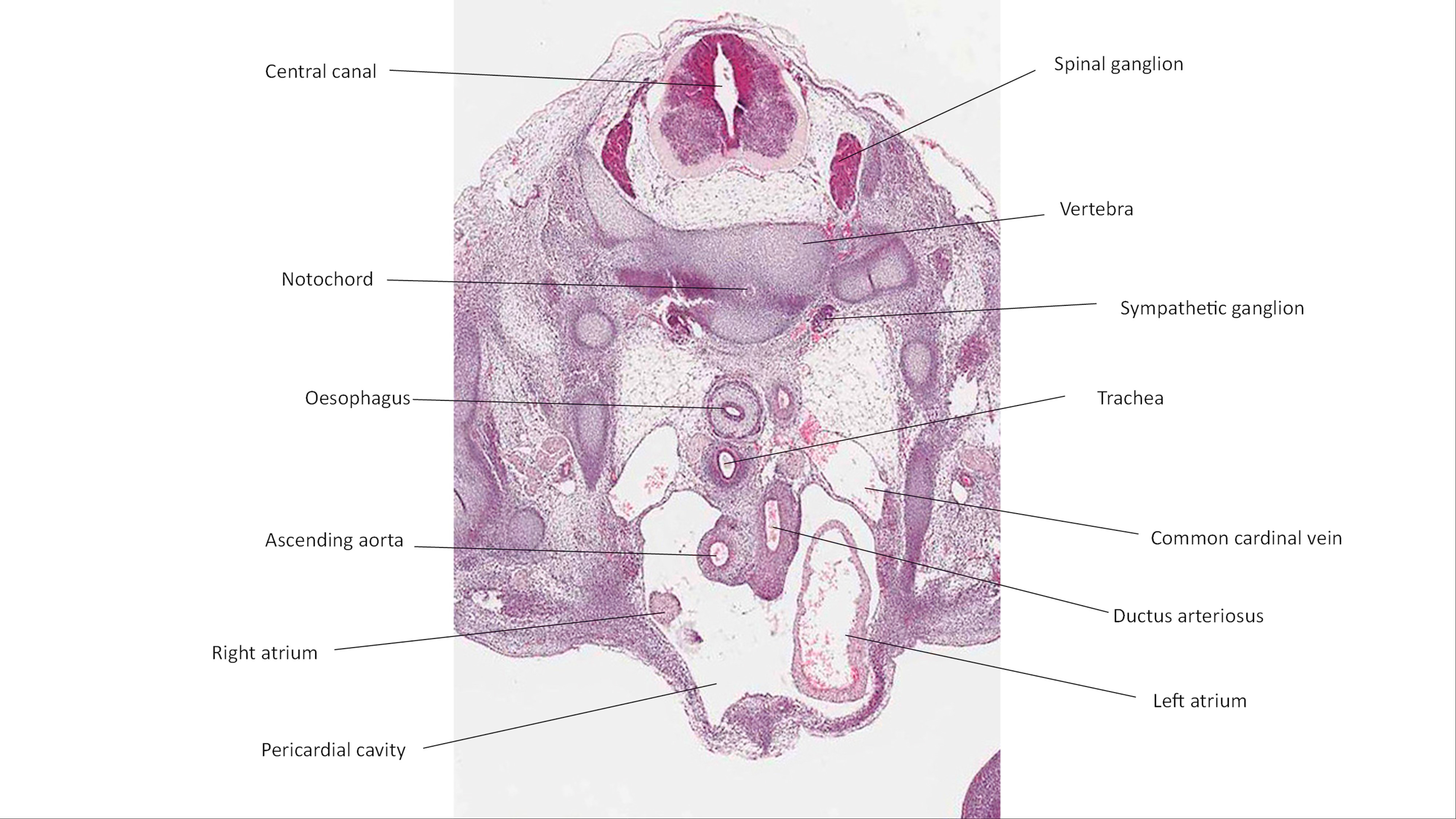 A histology section of a human embryo