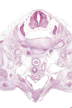 A histology section of a human embryo