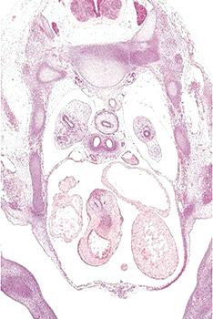 A histology section of a human embryo
