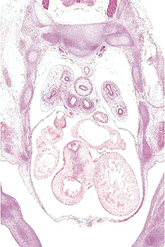 A histology section of a human embryo