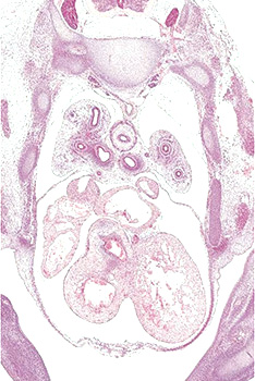 A histology section of a human embryo