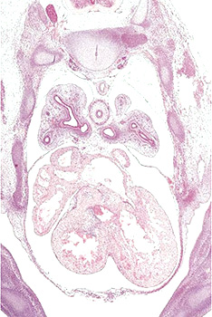 A histology section of a human embryo