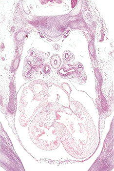 A histology section of a human embryo