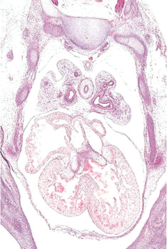 A histology section of a human embryo