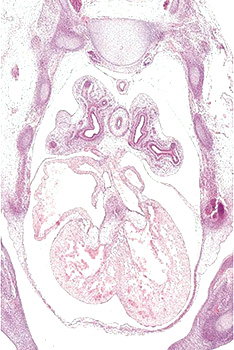A histology section of a human embryo