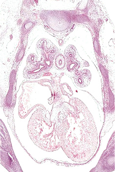 A histology section of a human embryo