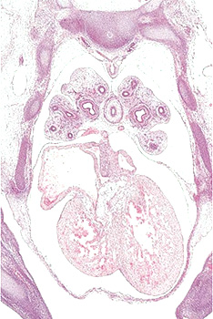 A histology section of a human embryo