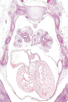 A histology section of a human embryo