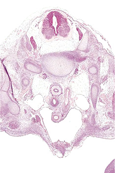A histology section of a human embryo