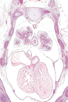 A histology section of a human embryo