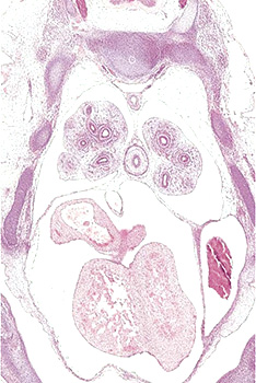 A histology section of a human embryo