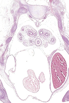 A histology section of a human embryo