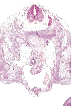 A histology section of a human embryo