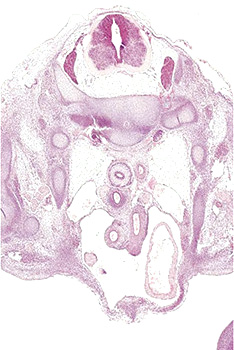A histology section of a human embryo