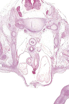 A histology section of a human embryo