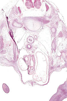 A histology section of a human embryo